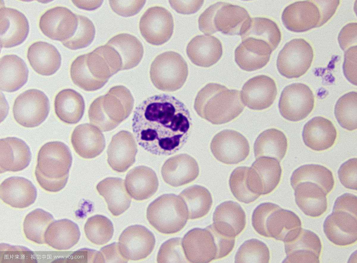 经常要看外周血涂片,红白细胞血小板这些在显微镜下就跟亲人似的,没