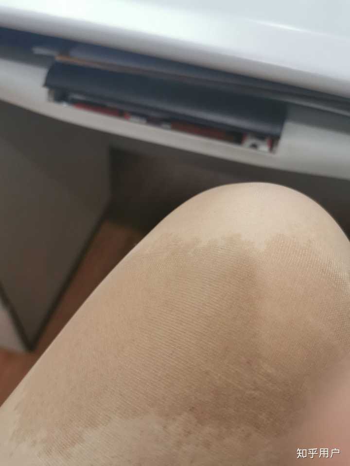 你见过什么特殊的胎记?