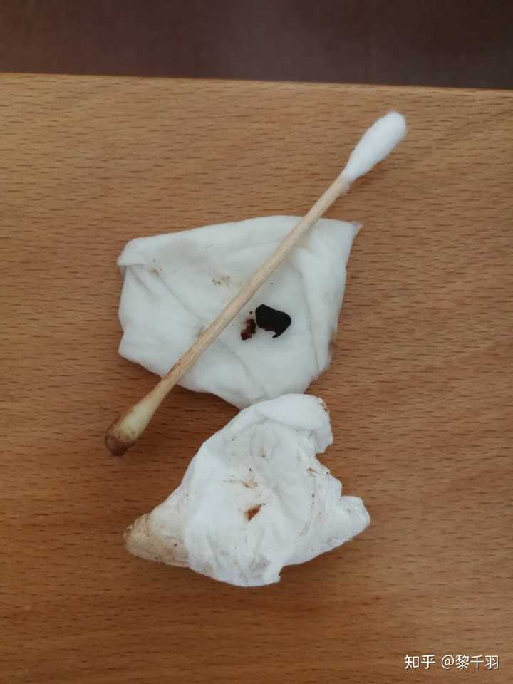 以上回答都是人的耳屎,我来上一个从五斤的小狗耳朵里掏出来的耳屎