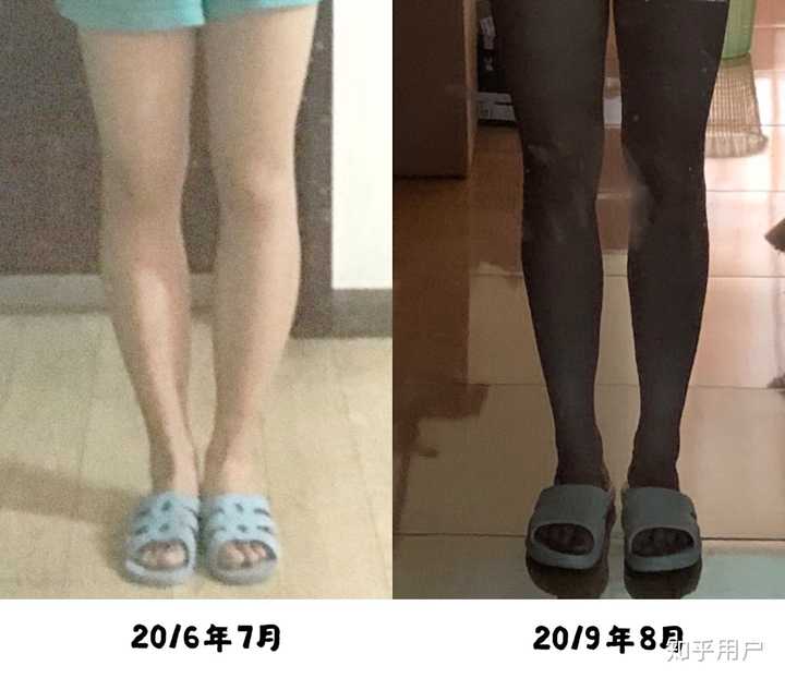 小腿能粗到什么地步