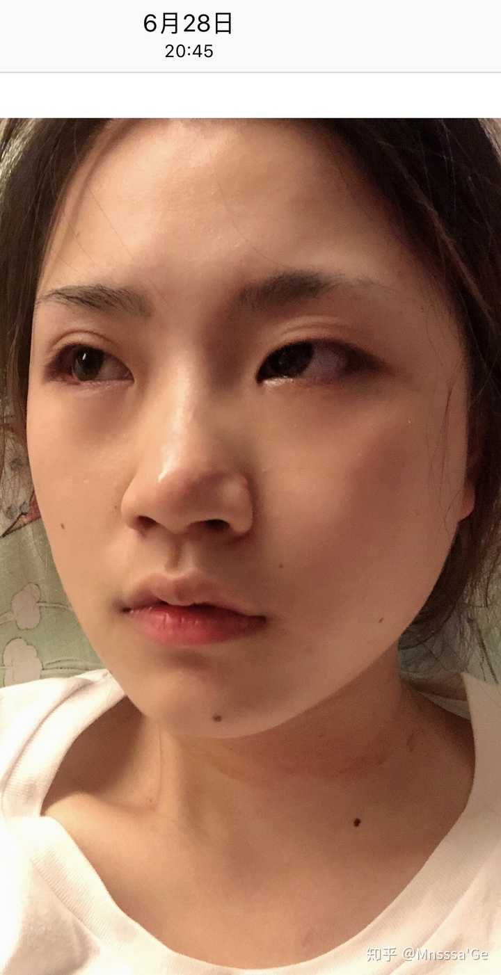 脖子上是勒痕 很可惜 我没死