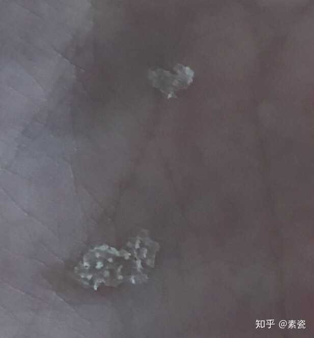 20190701我是干头发,一般两天或者三天一次洗头,平常没有头皮屑.