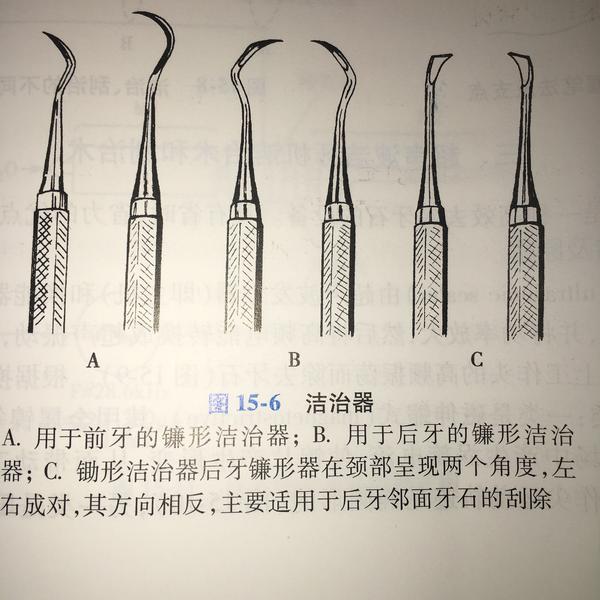 对于龈上洁治的超声器械一般来说「a」外形的工作尖,专业区分根据长度