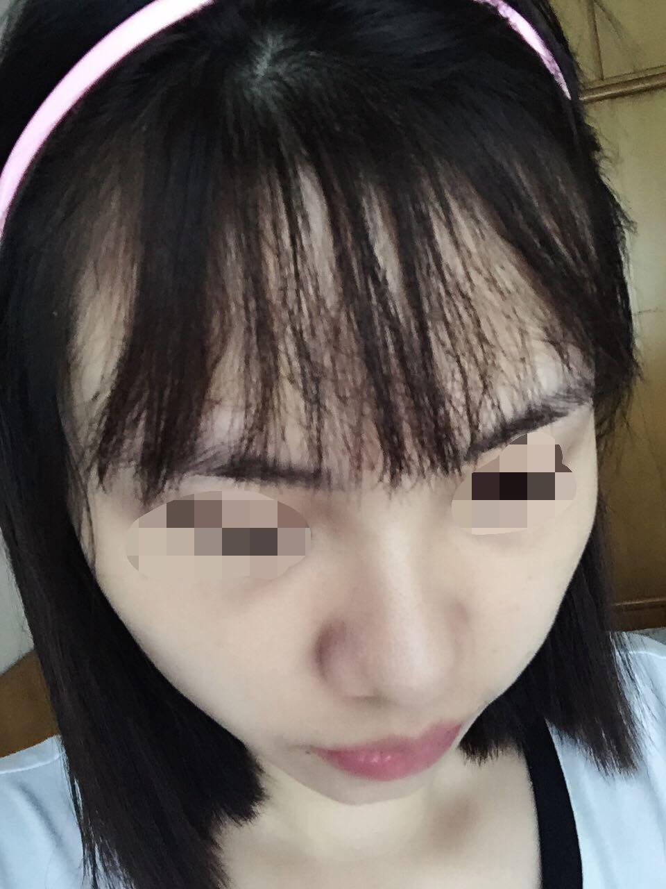 离子烫把<em>头发拉伤</em>了是什么因素影响拉发成败?