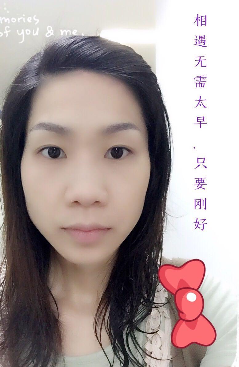 请问,如何才能有效去除额头上的痘印? - 莫嫡的