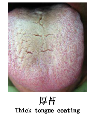 舌苔厚腻有酸腐气味,有什么办法可以去除吗?