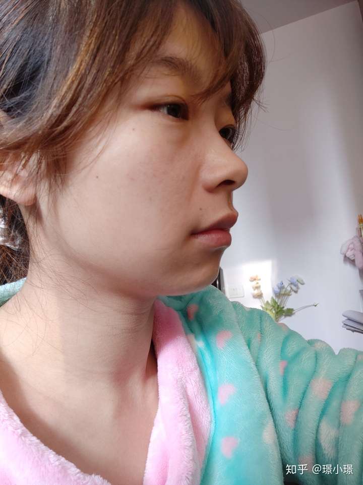 有没有嘴突却好看的人?