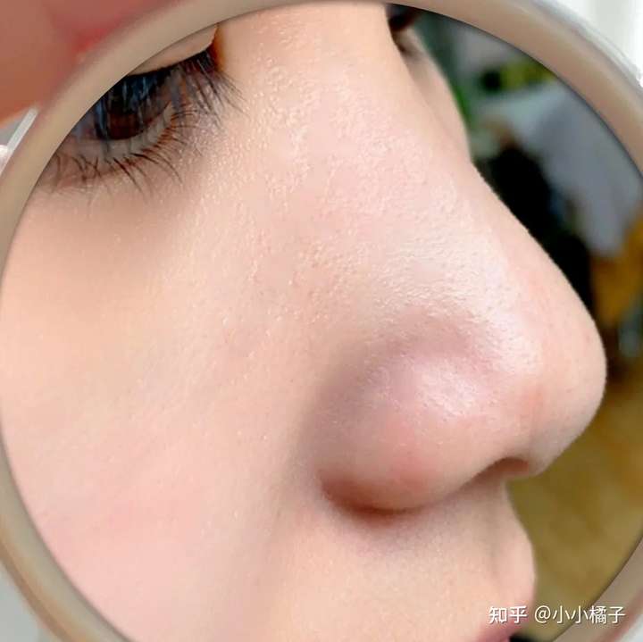 黄皮肤怎么有效美白?