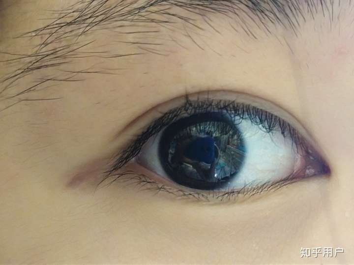 拥有一双清澈的眼睛是种什么体验?