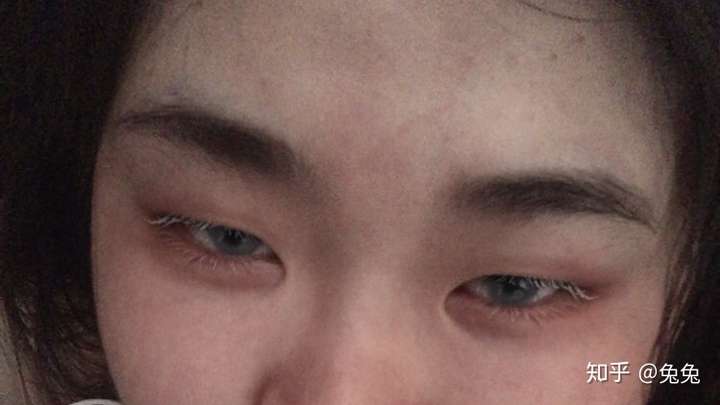 经常哭真的能让单眼皮变成双眼皮吗