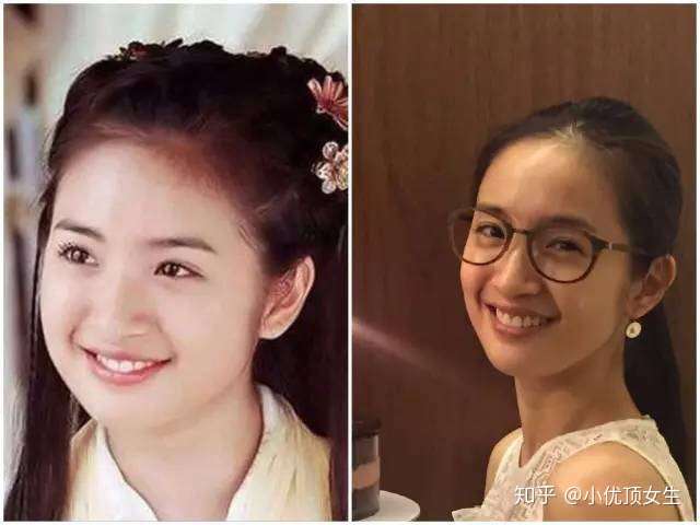 林依晨就是典型的婴儿肥式