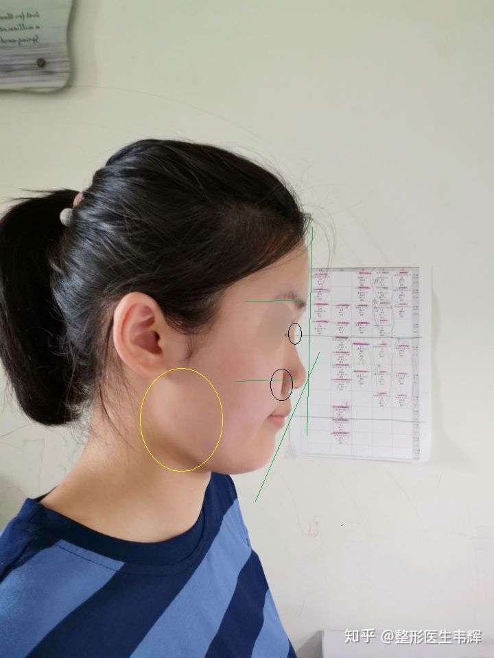 我的侧脸为什么这么奇怪?