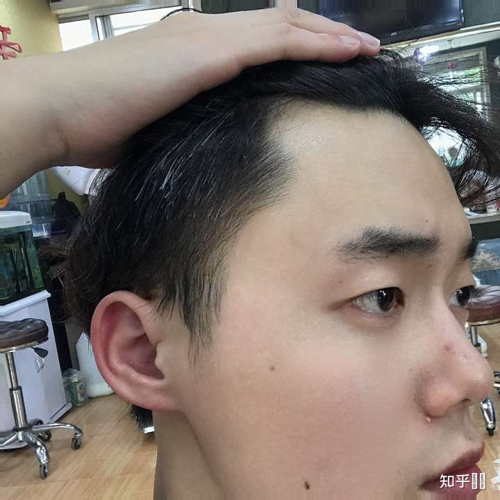男生发际线高是一种什么样的体验?