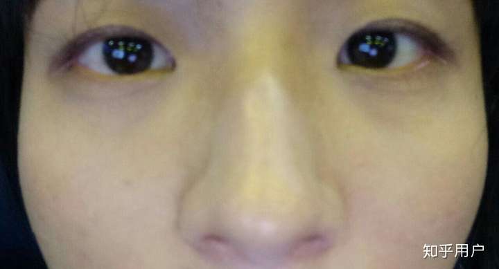 为什么有的人小眼睛大鼻子大嘴巴还很好看?