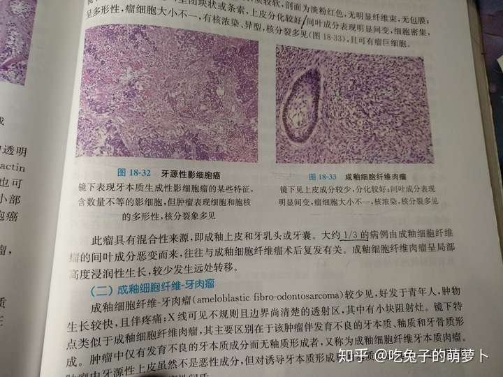 从良性肿瘤到恶性肿瘤要多久?