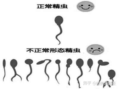 长期备孕无效精子质量不好要怎么调理呢