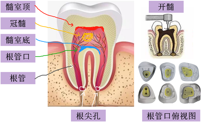 我想说口腔科实习生做根管治疗能看到根管口,但是手中的锉插不进去,我