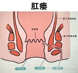 重庆有哪些好的肛肠医院肛门口长包还流脓水是怎么回事