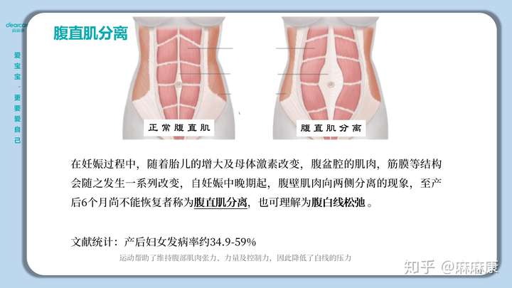 产后腹直肌和盆底肌修复有必要吗