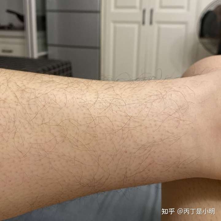 男生会觉得有腋毛的女生很恶心吗?