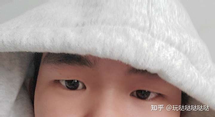 抑郁的人眼神都很空洞吗?