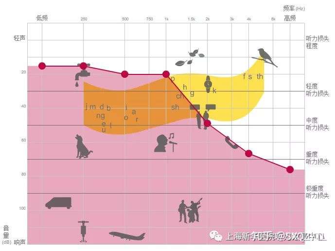 为什么很多听力损失从高频开始