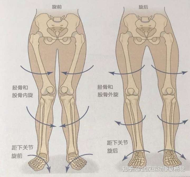 求救骨盆前倾到底xo型腿怎么改正