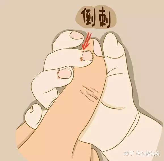 手指倒刺 知乎