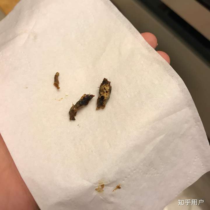 人需要掏耳朵吗