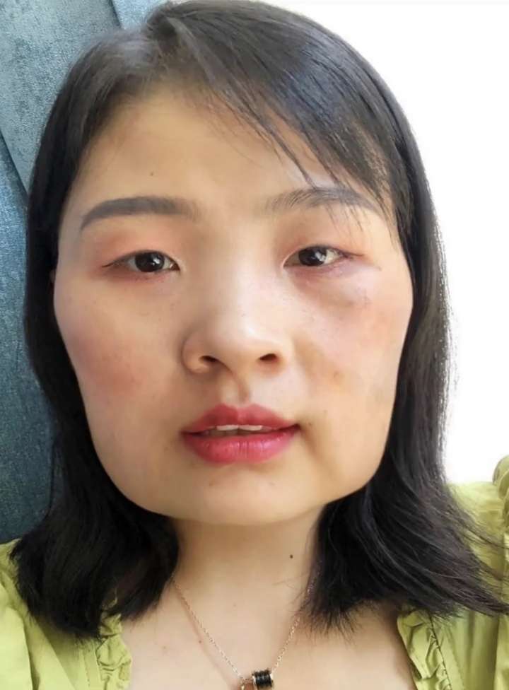 女生长得特别丑怎么办?