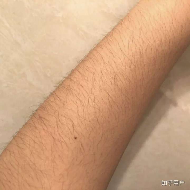 脱毛是用脱毛器还是脱毛膏好呢?