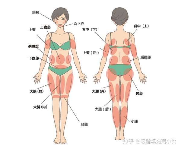 全身吸脂部位