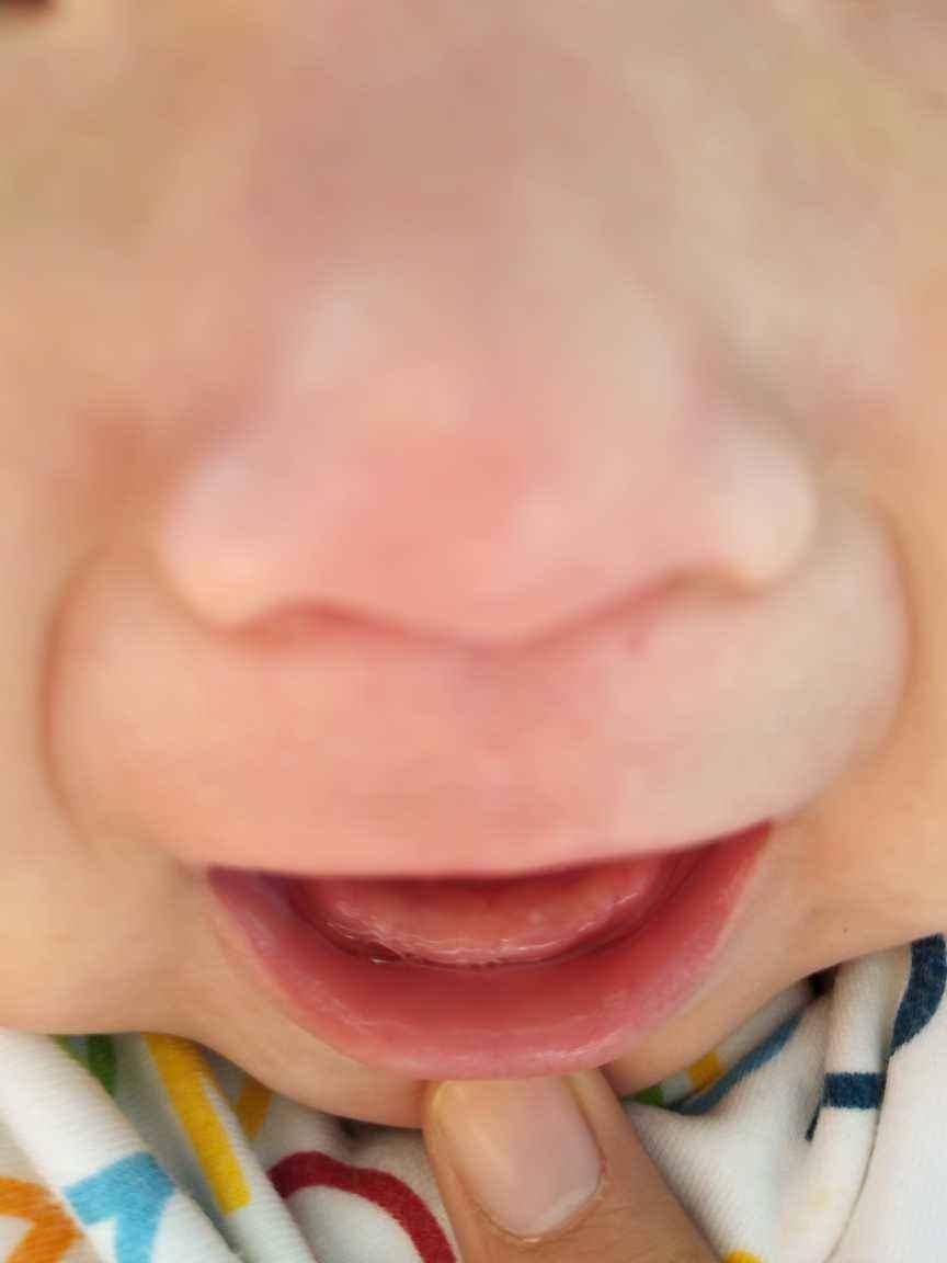 宝宝的出牙规律是怎么样的?