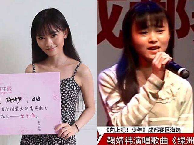 有哪些整容微整特别成功的明星