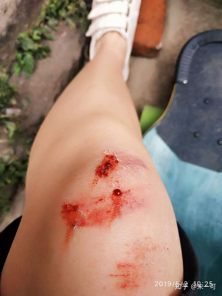 玩长板被摔的最惨的一次?