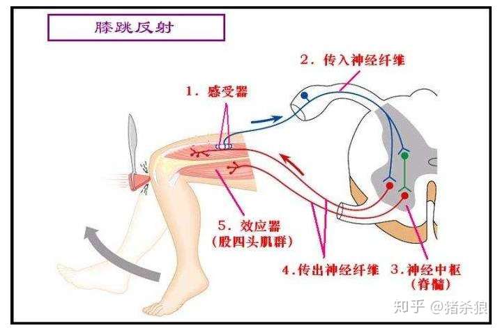 为什么选d,神经中枢不是坏了吗,为什么还能有膝跳反射?