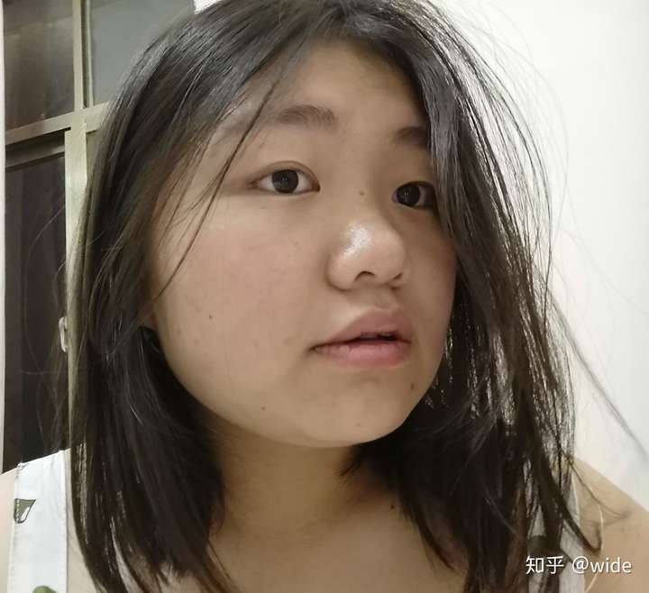 没有鼻梁,鼻子塌的人是什么体验?