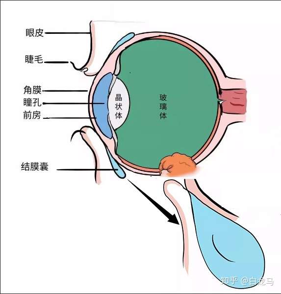 眼球的前半部分和上下眼睑表面覆盖的一张完整膜结构,由睑结膜,球