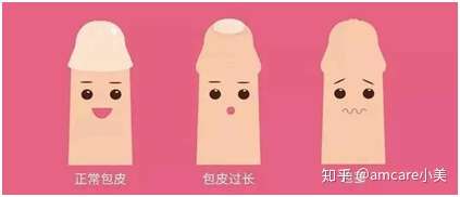 男孩什么时候情况下需要割包皮呢?