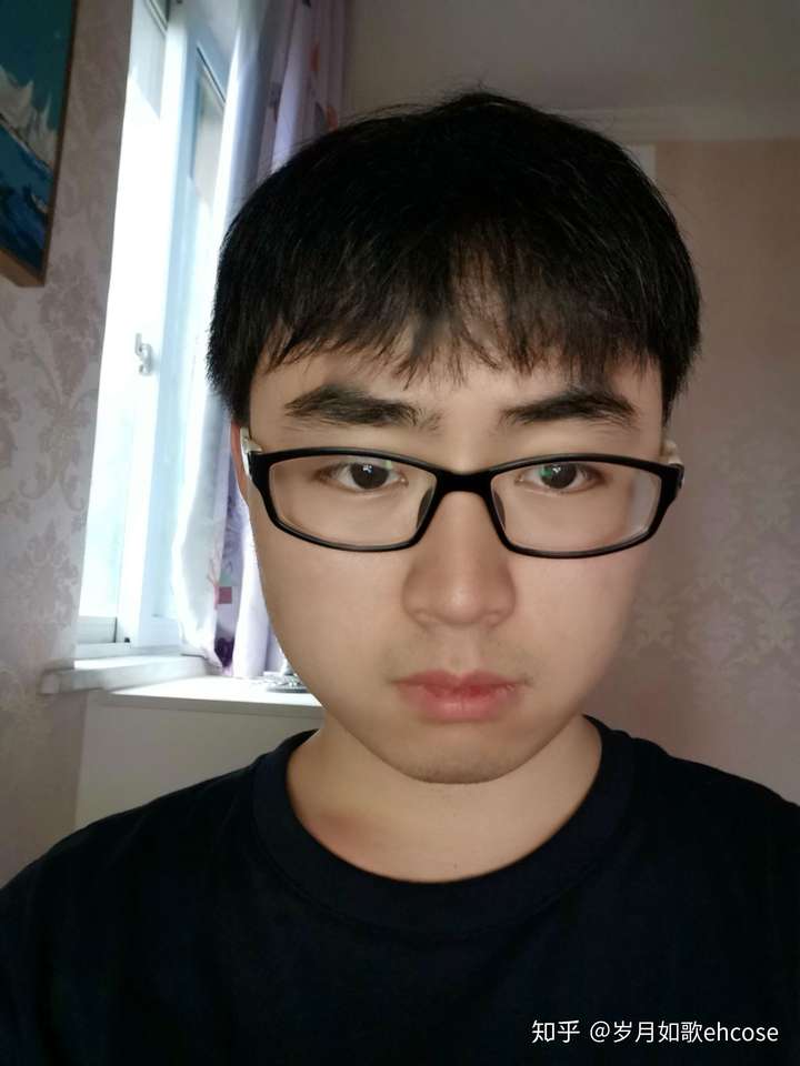 我这大小脸还有救吗特别自卑不敢拍照已上图