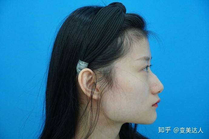 上海下颌角反馈