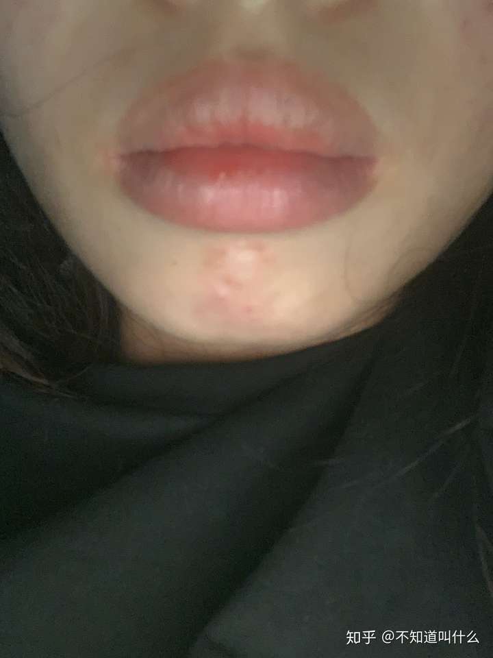 上嘴唇较厚的女生怎样涂口红?