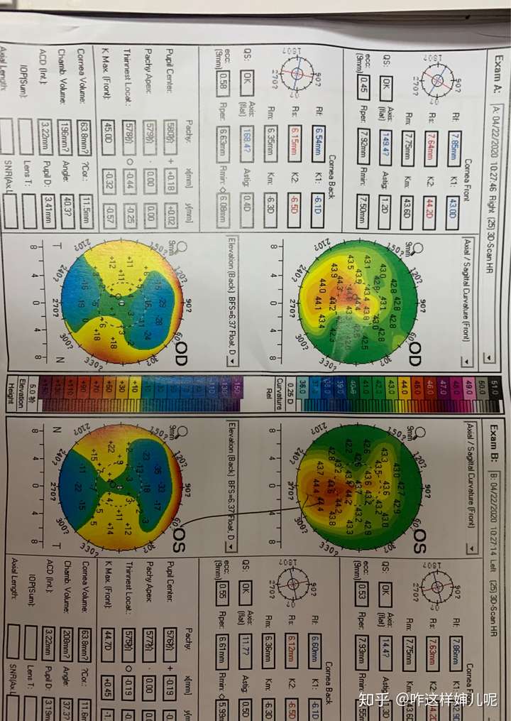 可以帮我看看角膜地形图吗,我怕圆锥角膜?