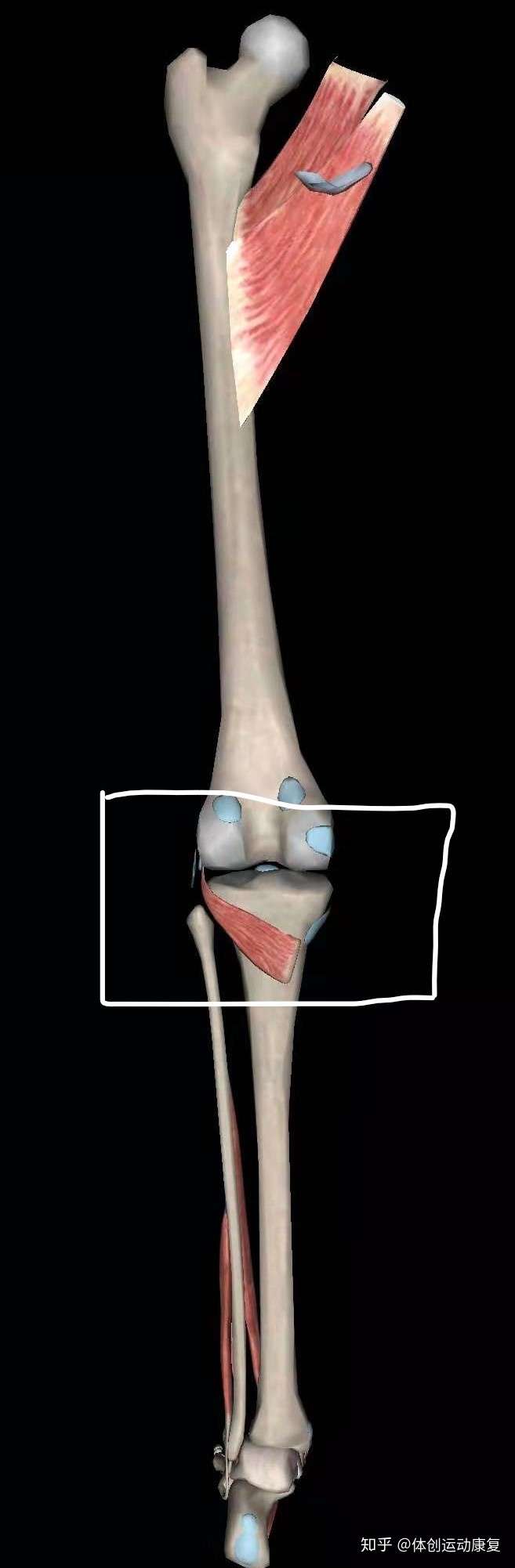 您好,在膝窝处解剖结构有:腘肌,腓肠肌止点,后交叉韧带,前交叉韧带 1