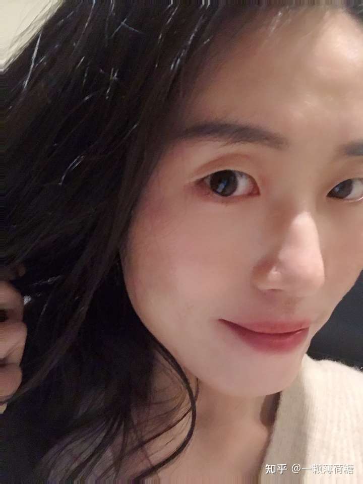 单眼皮不易衰老 老了之后可能因为眼窝加深变成大双眼皮 单眼皮的小