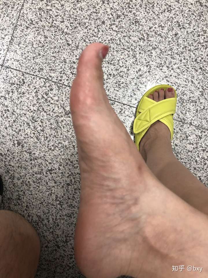 脚趾翘的人根本穿不了乐福鞋,奶奶鞋,大脚趾会被鞋面顶的非常疼