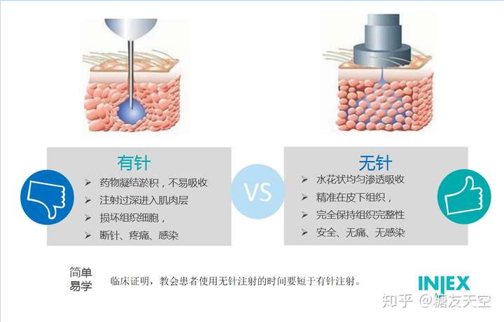 无针注射器注射胰岛素是什么原理?无针注射器真的可以