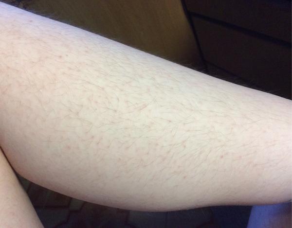 女生体毛旺盛是什么样的体验?