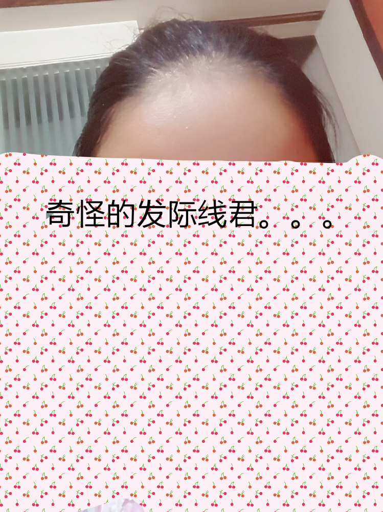 <em>初中生掉头发</em>正常吗? - 病房里的奈奈安的回答