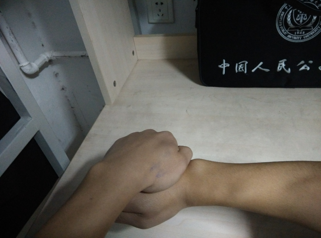 臂或者左手未成功固定己方后脑勺,应该以两只手的力量对抗对方右小臂